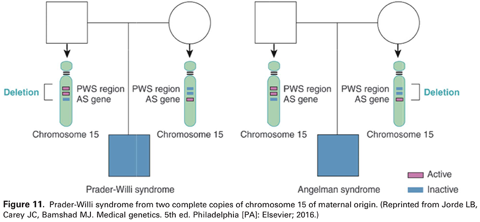 Figure 11. Prader-Willi syndrome from two complete copies of chromosome 15 of maternal origin. (Reprinted from Jorde LB, Carey JC, Bamshad MJ. Medical genetics. 5th ed. Philadelphia [PA]: Elsevier; 2016.) 